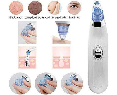 Blackhead Removal Machine | Derma Suction 3 In 1 Black Head Remover Machine | Acne Pimple Pore Cleaner Vacuum Suction Tool - Pak flow